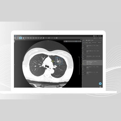 体素科技 放射AI解决方案 AI诊断