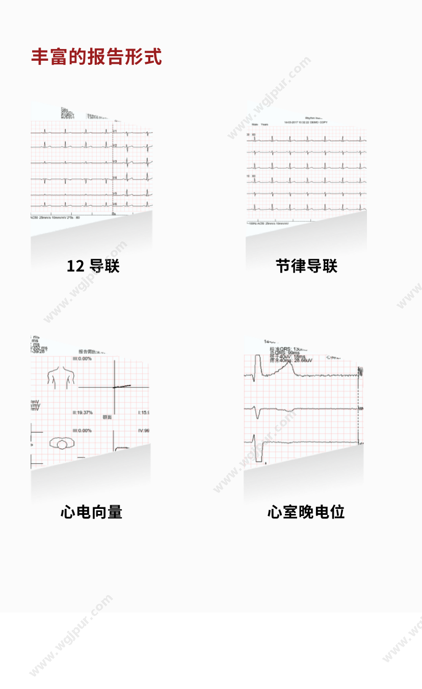 瑞康宏业 e1200 生命监测