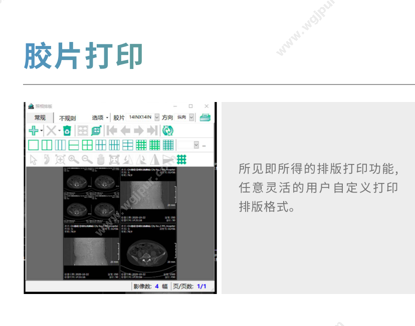 索图科技 SEEKER-MINIPACS1.0 放射影像