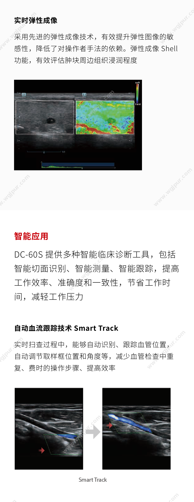 医信通 DC-60S 超声影像