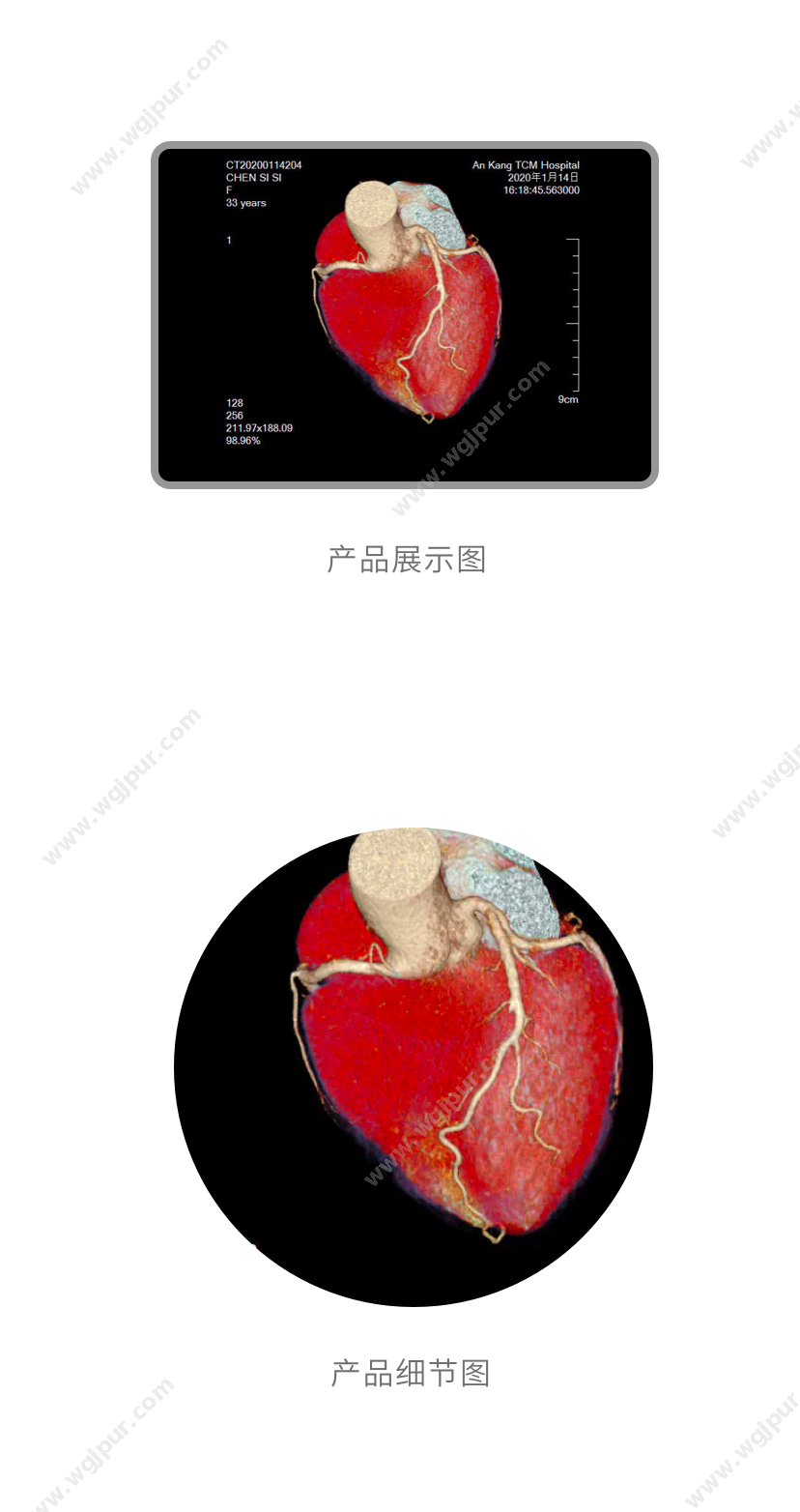 博动医疗 Angio Plus BeaconⅡ 体外诊断