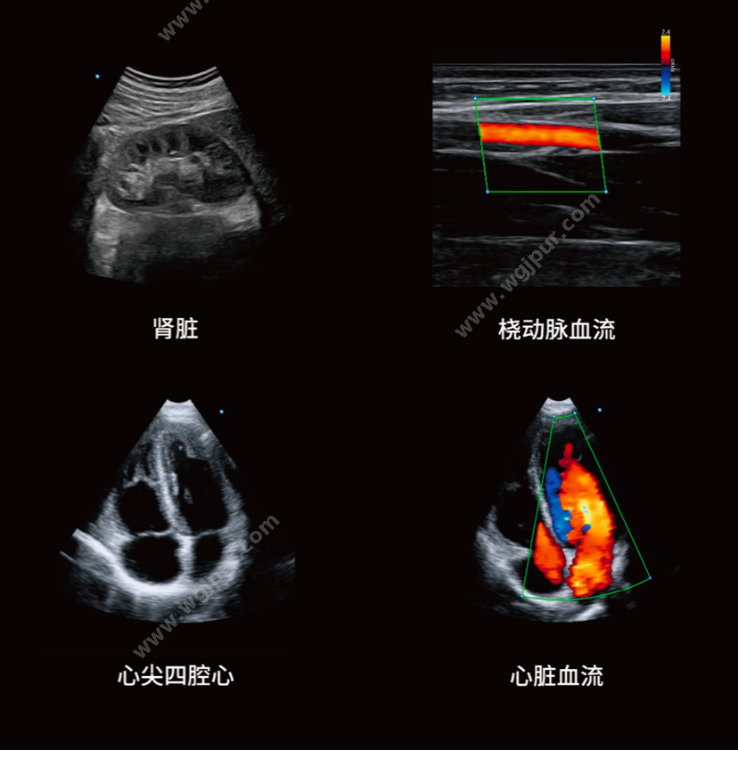 华大云影 H1（探头3选1，凸阵/线阵/相控阵） 超声影像