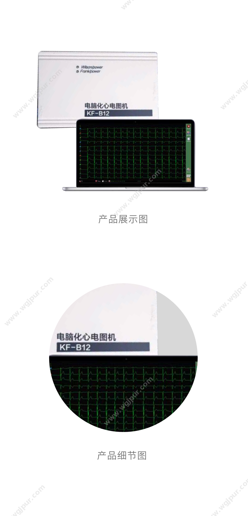 可孚医疗 KF-B12（含笔记本电脑+软件+采集盒 +打印机） 生命监测