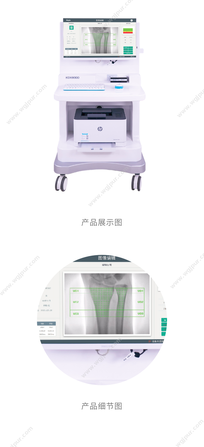 南京科进 KDX8000 放射影像