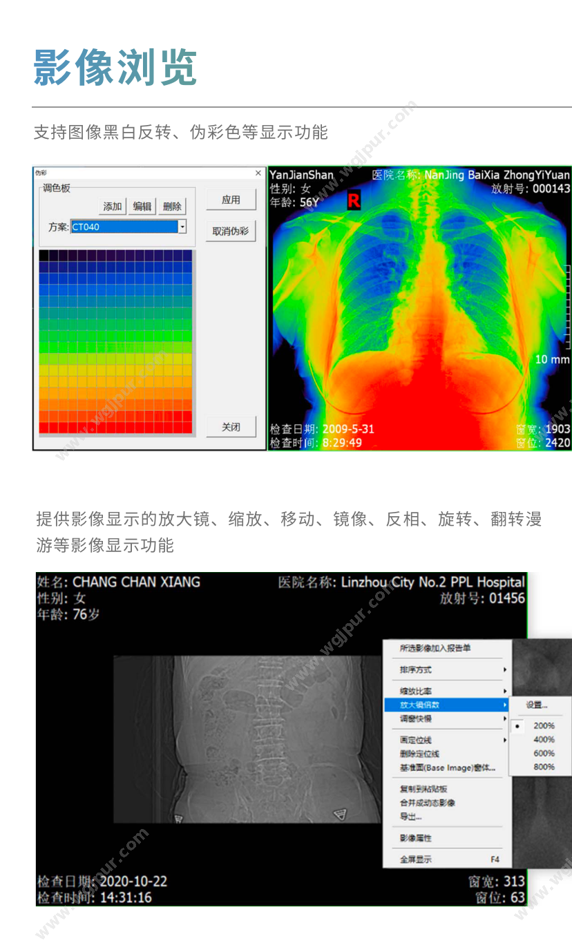 索图科技 SEEKER-MINIPACS1.0 放射影像