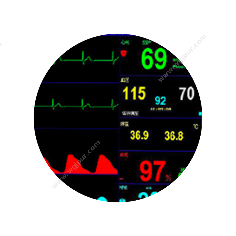 瑞博科技 PM-9000（转运监护仪） 生命监测