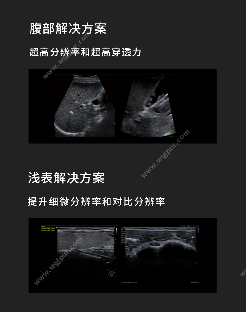 飞依诺 默认规格 超声影像