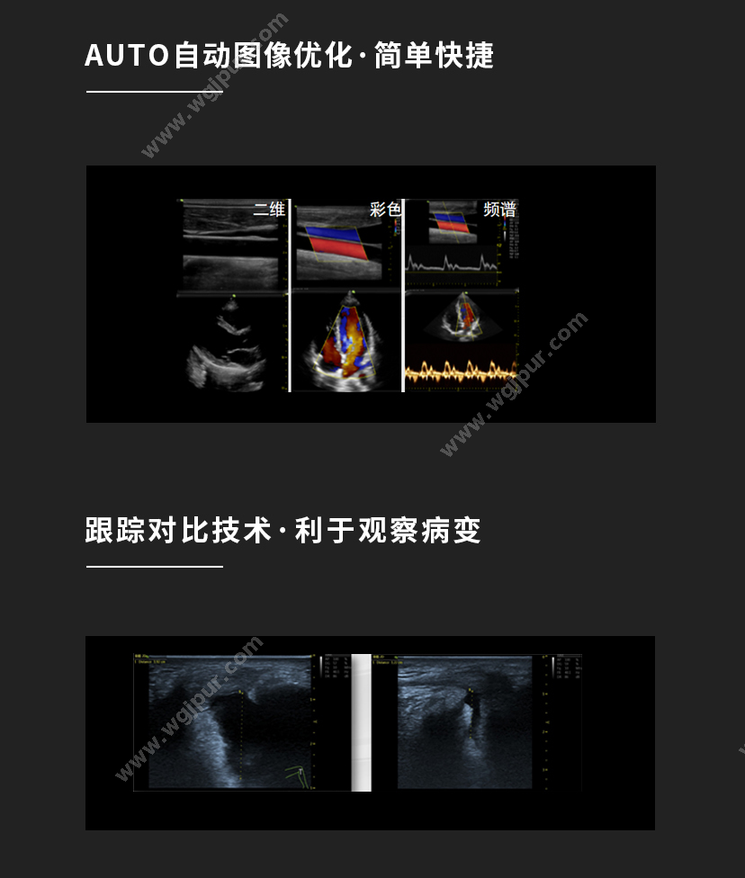 飞依诺 默认规格 超声影像