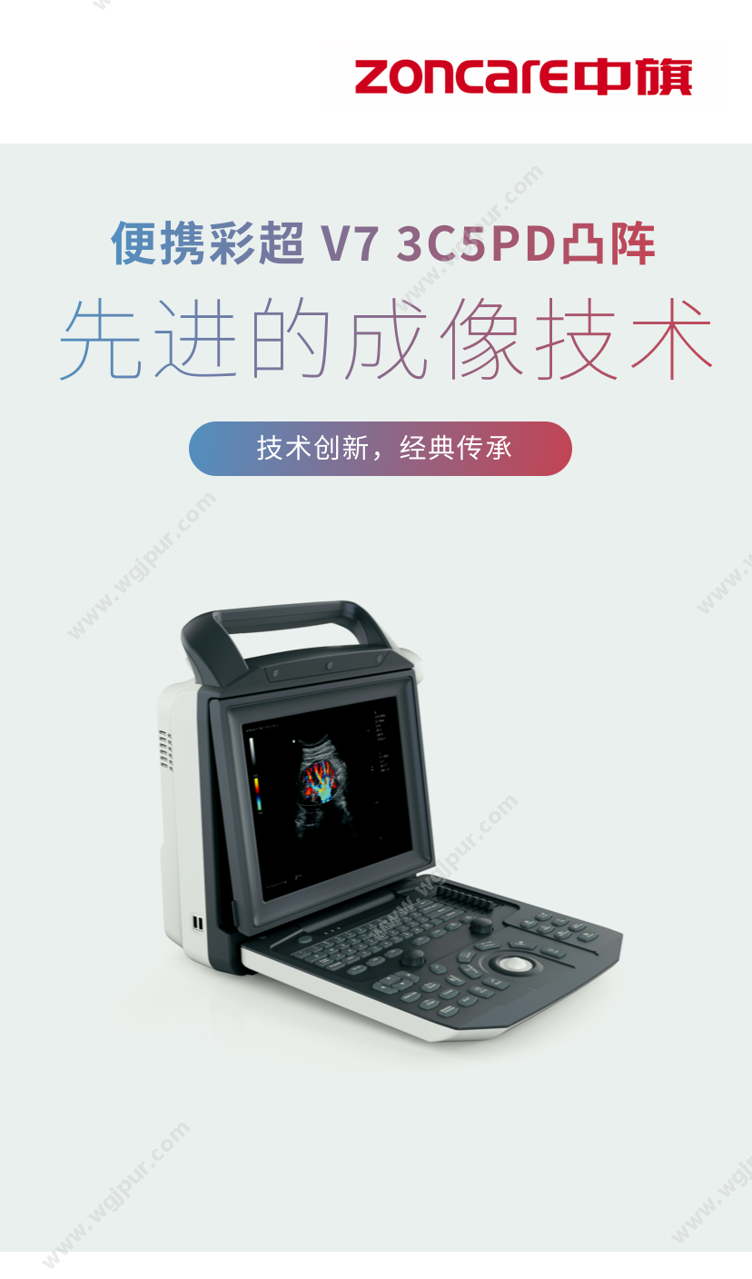 中旗医疗 V7 3C5PD凸阵 超声影像