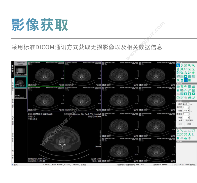 索图科技 SEEKER-MINIPACS1.0 放射影像