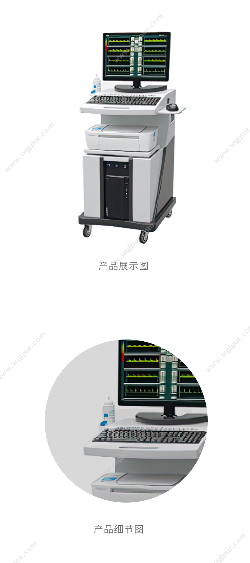 亿康盈联 EK-1000B型(单通道多深度+标配二探头 视频指导安装培训) 超声影像