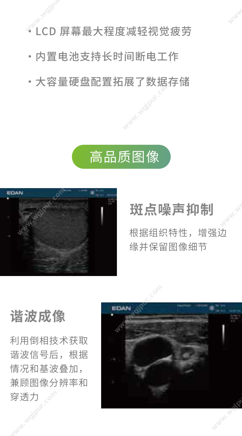 理邦 U20 超声影像