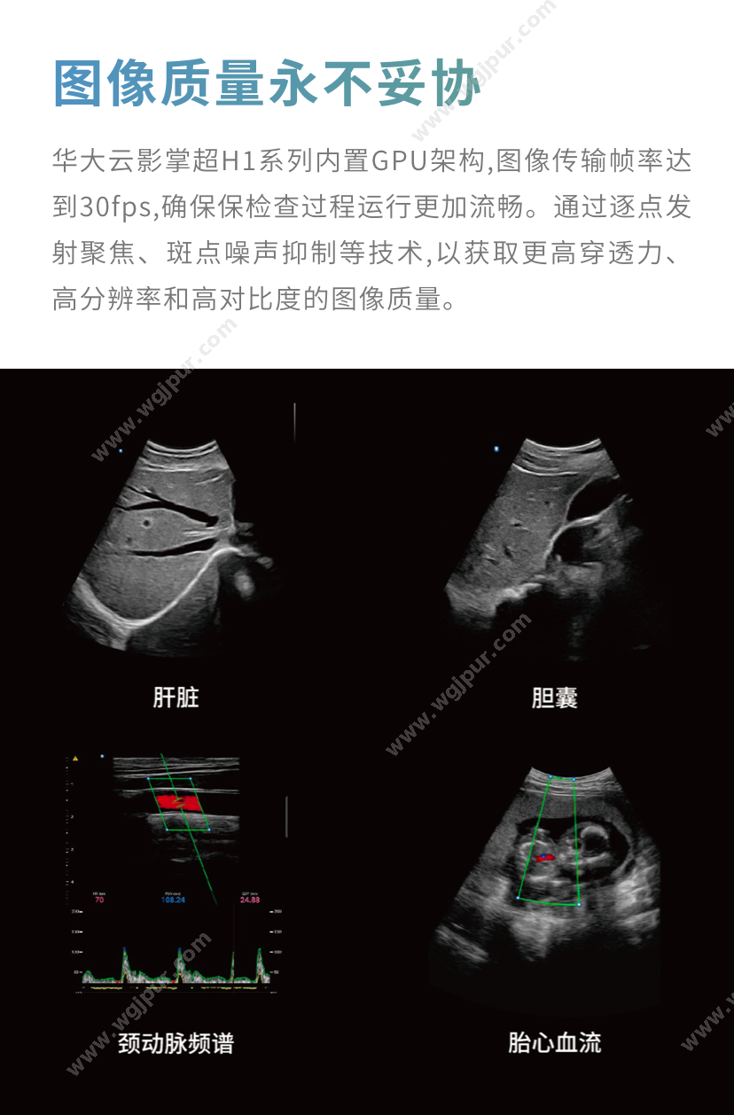 华大云影 H1（探头3选1，凸阵/线阵/相控阵） 超声影像