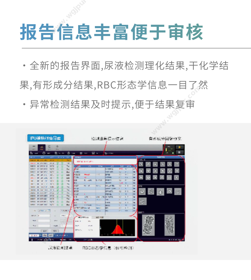 优利特 US-1681 体外诊断