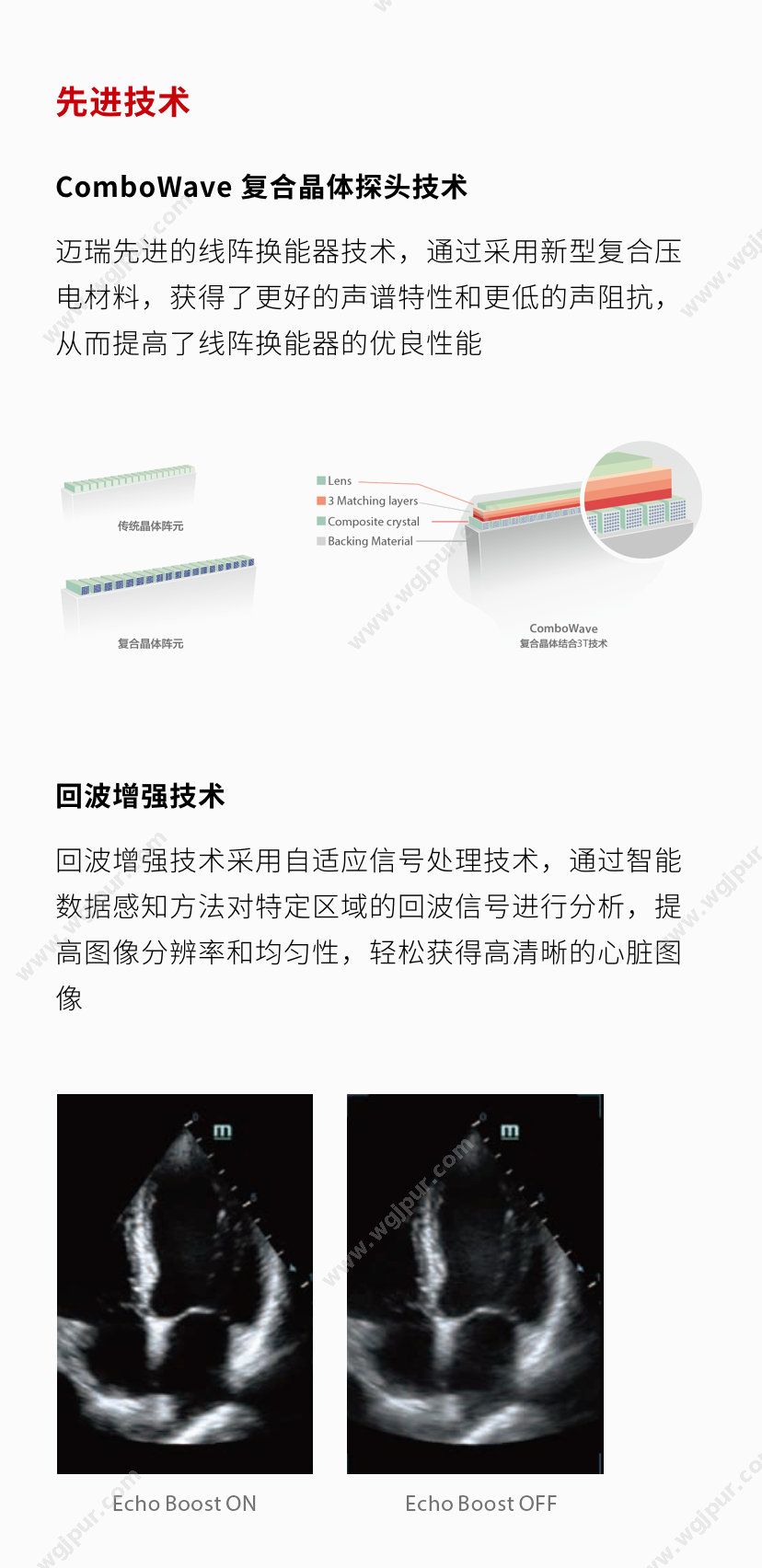 医信通 DC-60S 超声影像