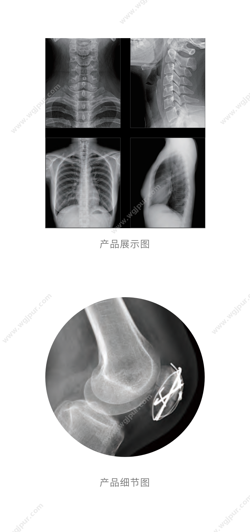 顺腾 14x17英寸  1箱（500张） 医用耗材