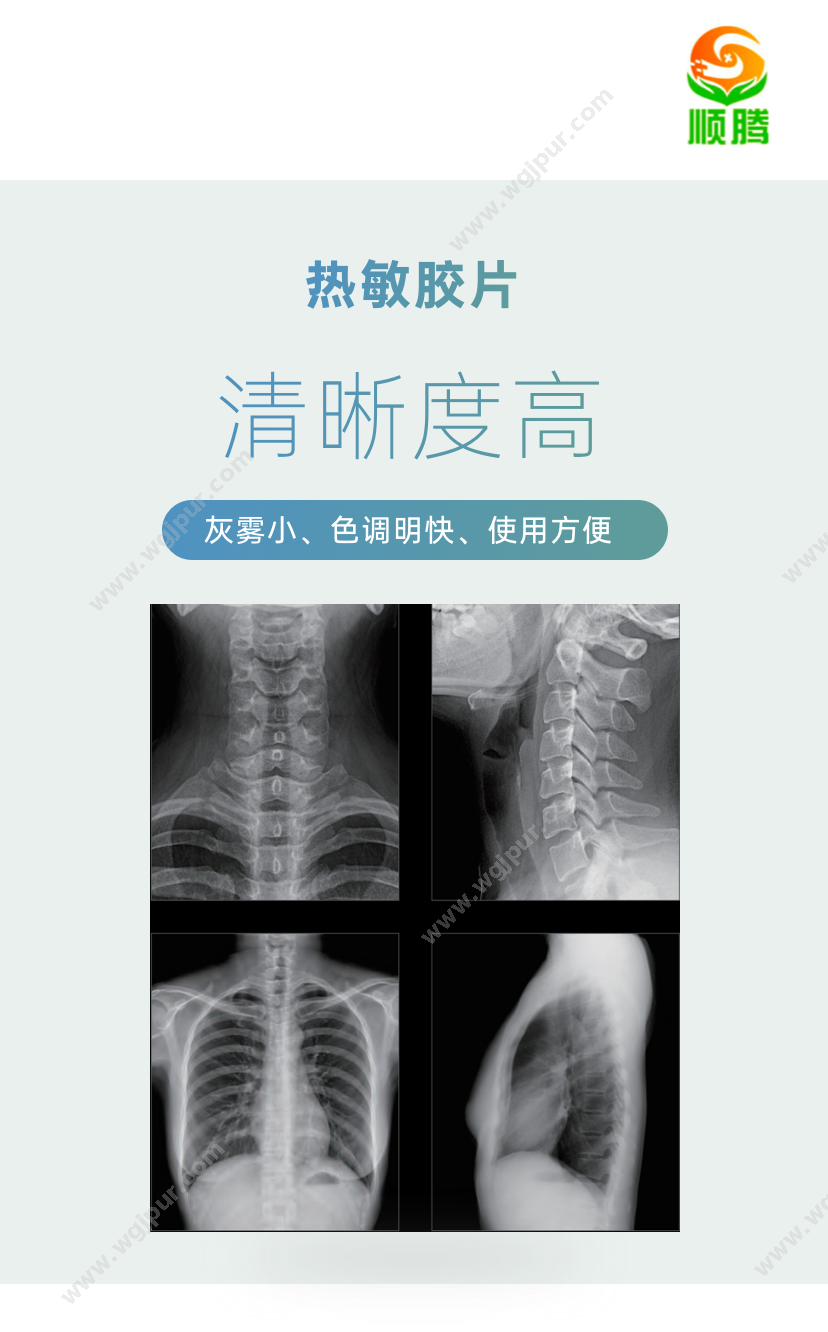 顺腾 14x17英寸  1箱（500张） 医用耗材