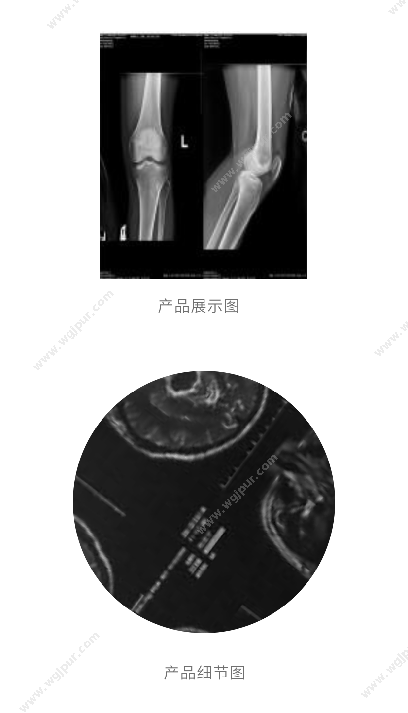 顺腾 ST-GX 14x17英寸1件（500张）仅适用于富士激光相机 医用耗材