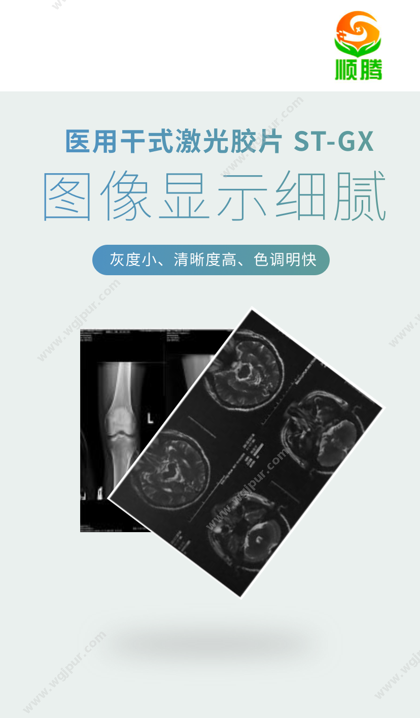 顺腾 ST-GX 14x17英寸1件（500张）仅适用于富士激光相机 医用耗材