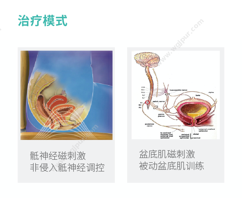 麦澜德 MS080 治疗设备