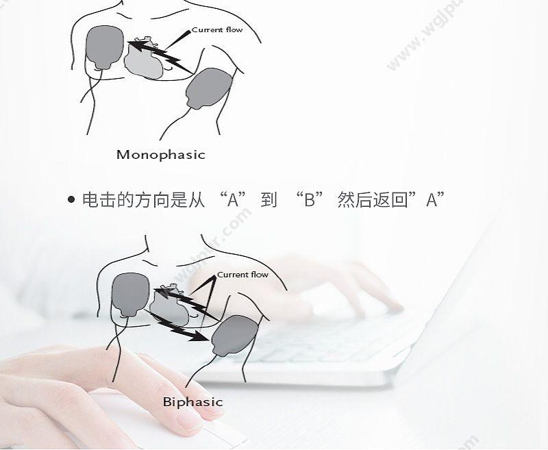 普美康 PRIMEDIC 半自动体外除颤器Defibrillators HeartSave AED（M250） 除颤AED