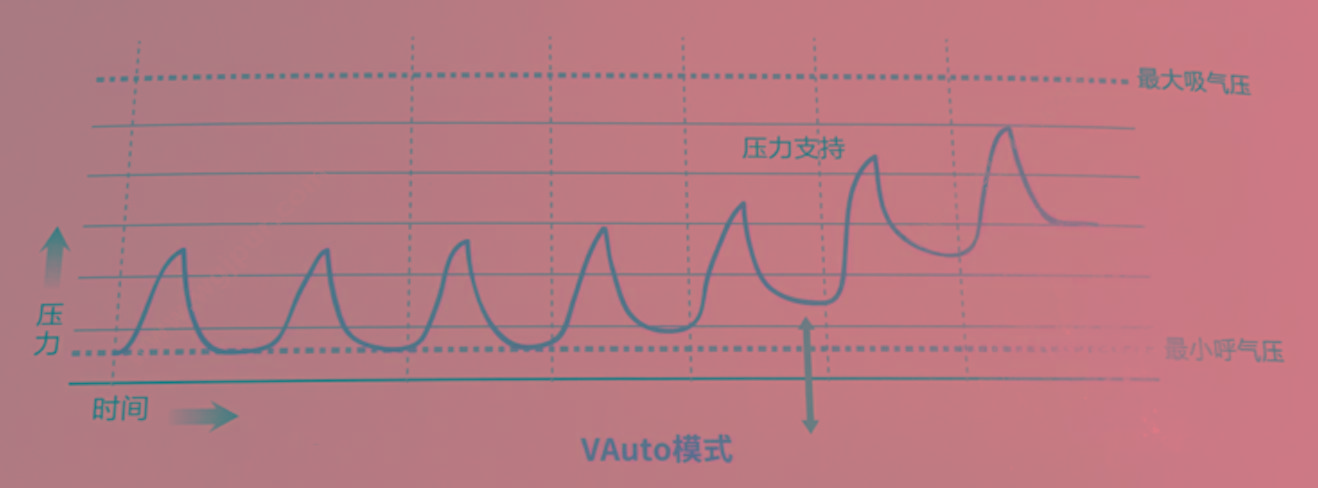 瑞思迈 ResMed 双水平正压通气呼吸机 S9 Auto25（国产） 睡眠呼吸机