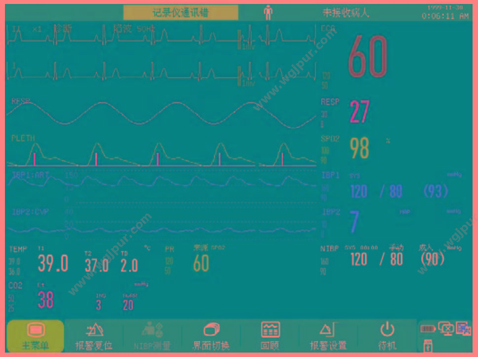 科曼 COMEN STAR8000E（三导联） 病人监护仪