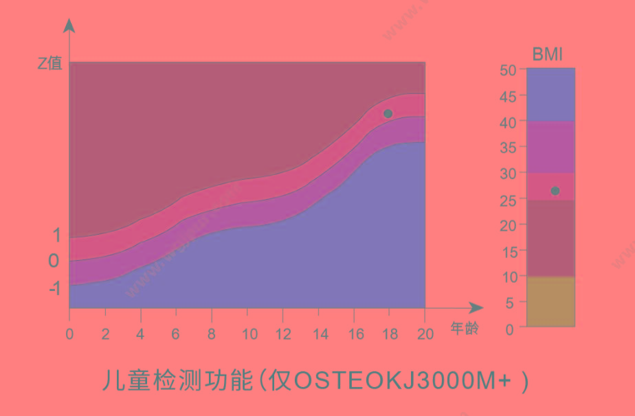 科进 Kejin OSTEOKJ3000M 超声骨密度仪