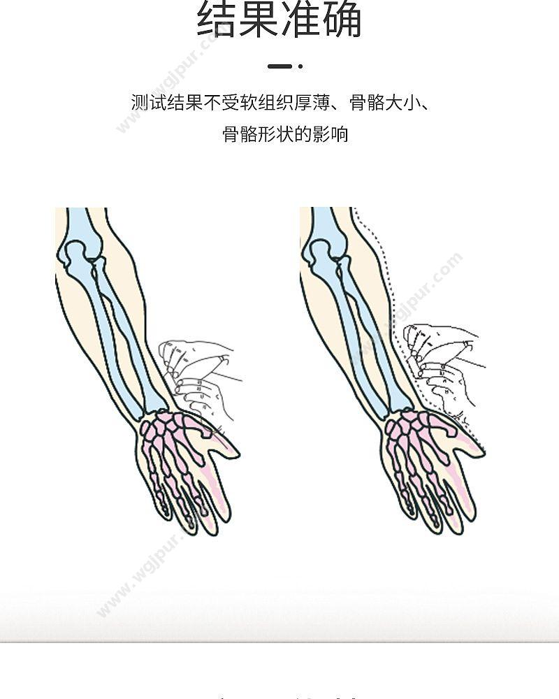 科进 Kejin OSTEOKJ7000+便携式 超声骨密度仪