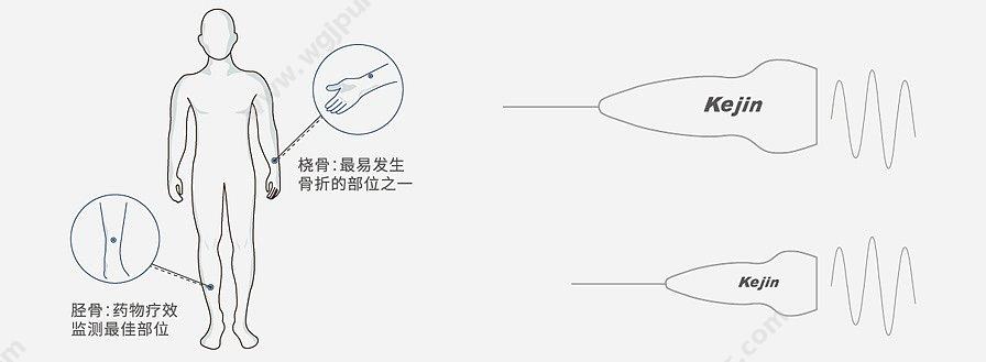 科进 Kejin OSTEOKJ7000++双屏 超声骨密度仪