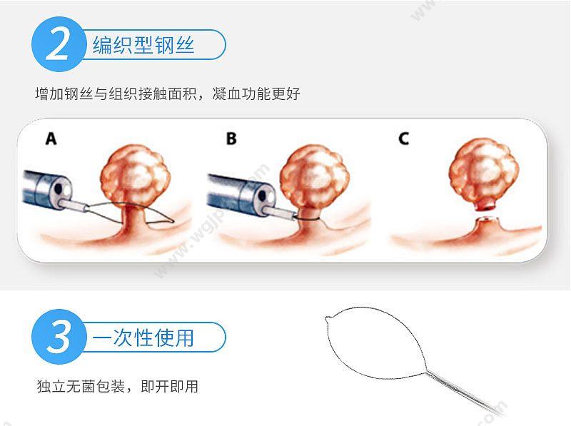 南微医学 MTN-PFS-E-15/18（10支/盒 10盒/箱） 一次性圈套器