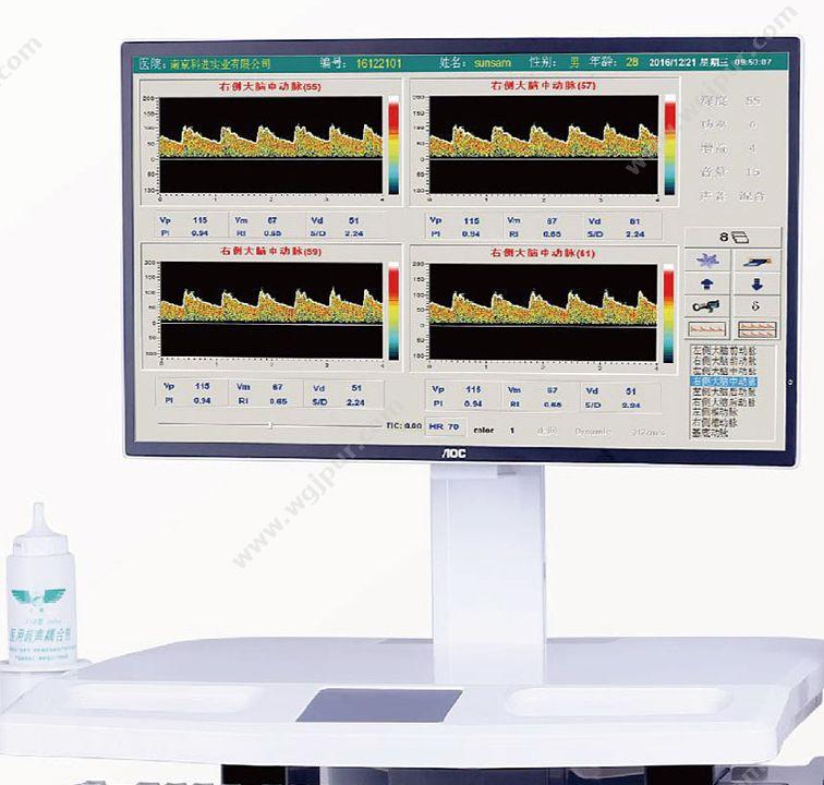 科进 Kejin 超声经颅多普勒血流分析仪 KJ-2V6M+ 经颅多普勒