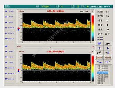 科进 Kejin 超声经颅多普勒血流分析仪 KJ-2V6M 经颅多普勒