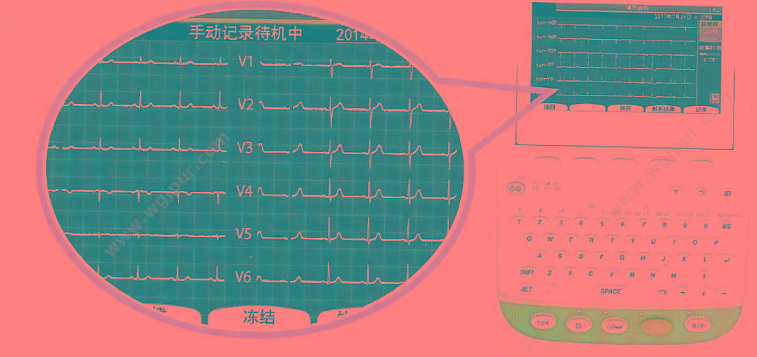 日本光电 NIHON KOHDEN 心电图机 ECG-2360 心电图机