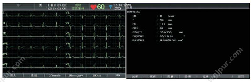 理邦 EDAN 数字式十二道心电图机 SE-1201 心电图机