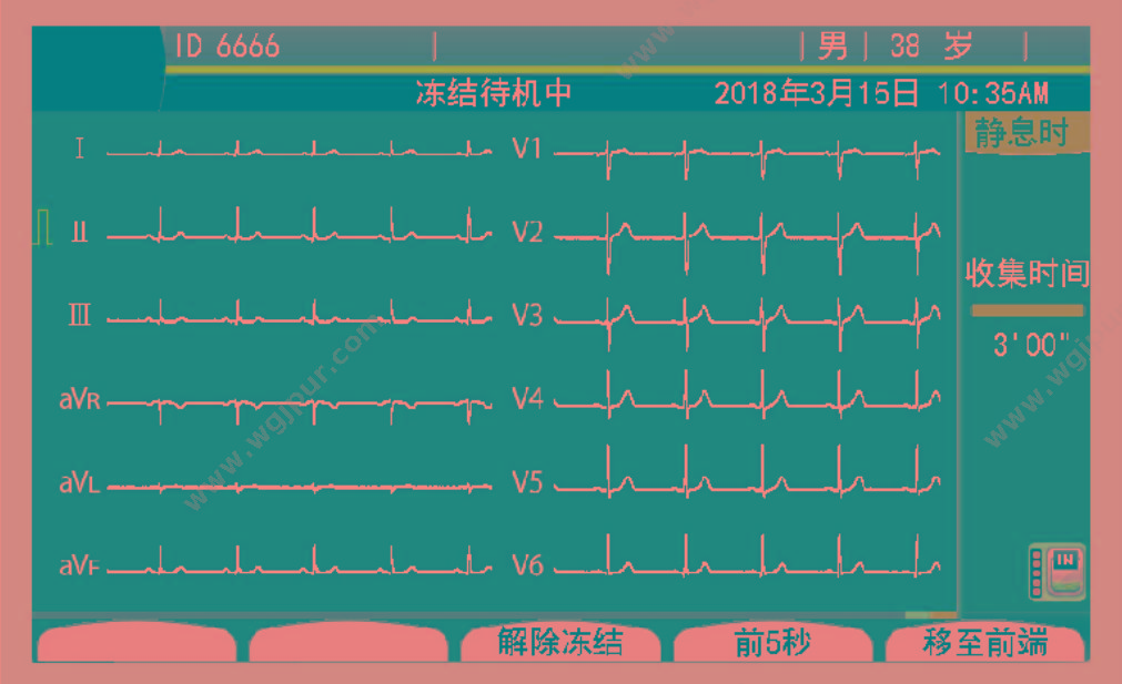 日本光电 NIHON KOHDEN 六道心电图机 ECG-2250 心电图机