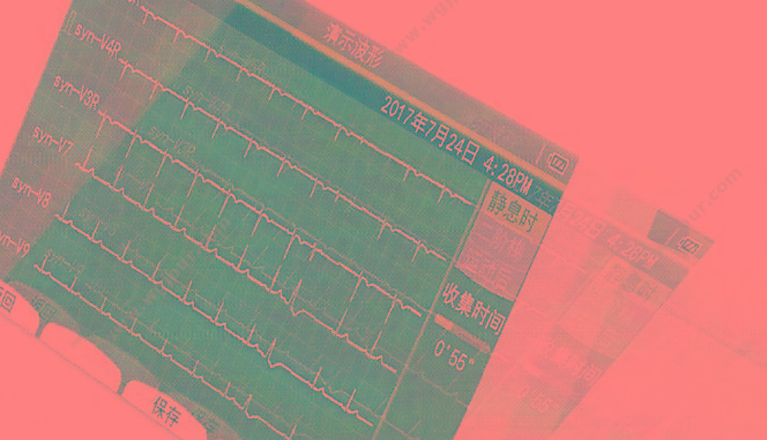 日本光电 NIHON KOHDEN 心电图机 ECG-2360 心电图机