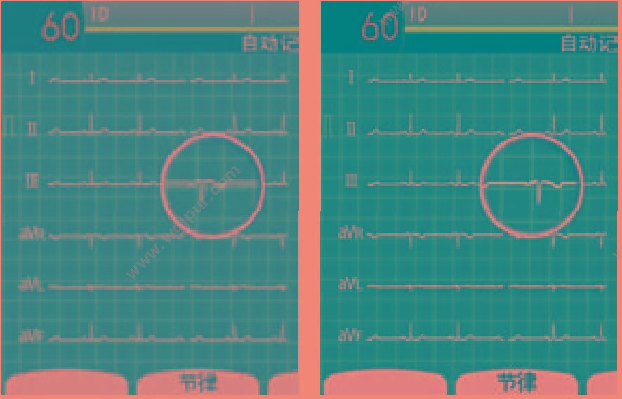 上海光电 多道心电图机 ECG-2350 心电图机