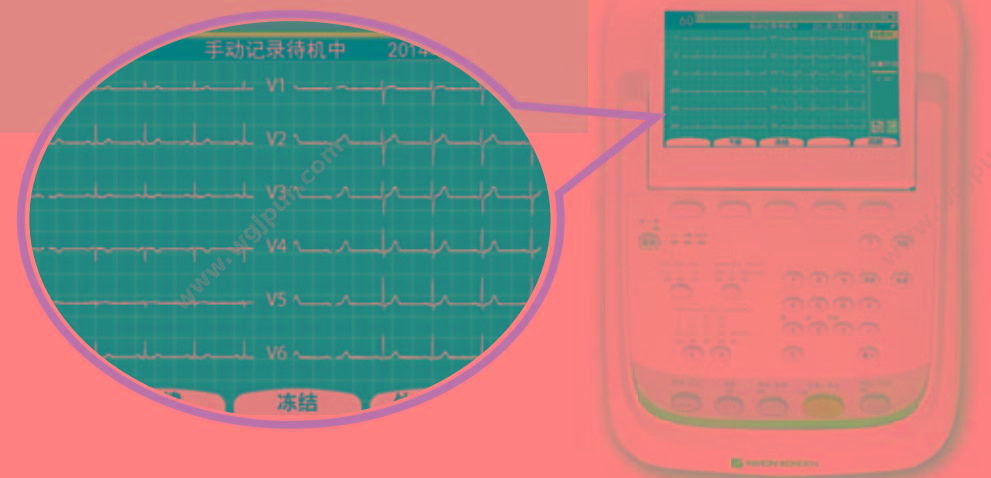 上海光电 多道心电图机 ECG-2350 心电图机