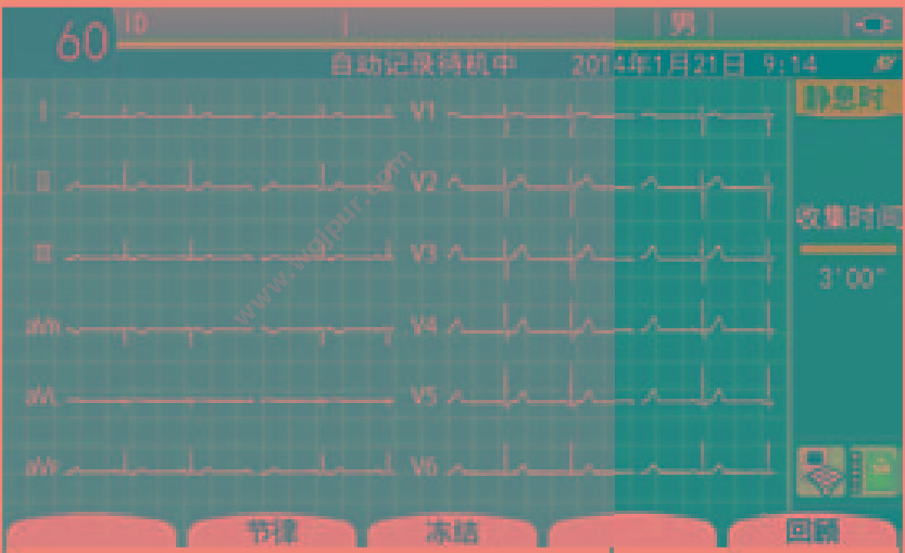 上海光电 多道心电图机 ECG-2350 心电图机