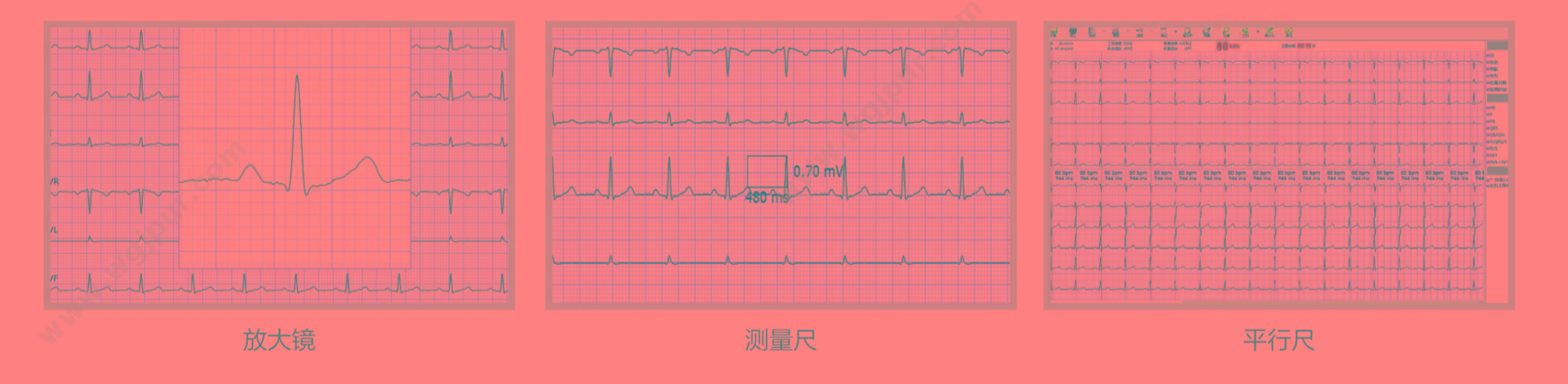 华清心仪 数字化心电工作站 PE-1201 心电图机