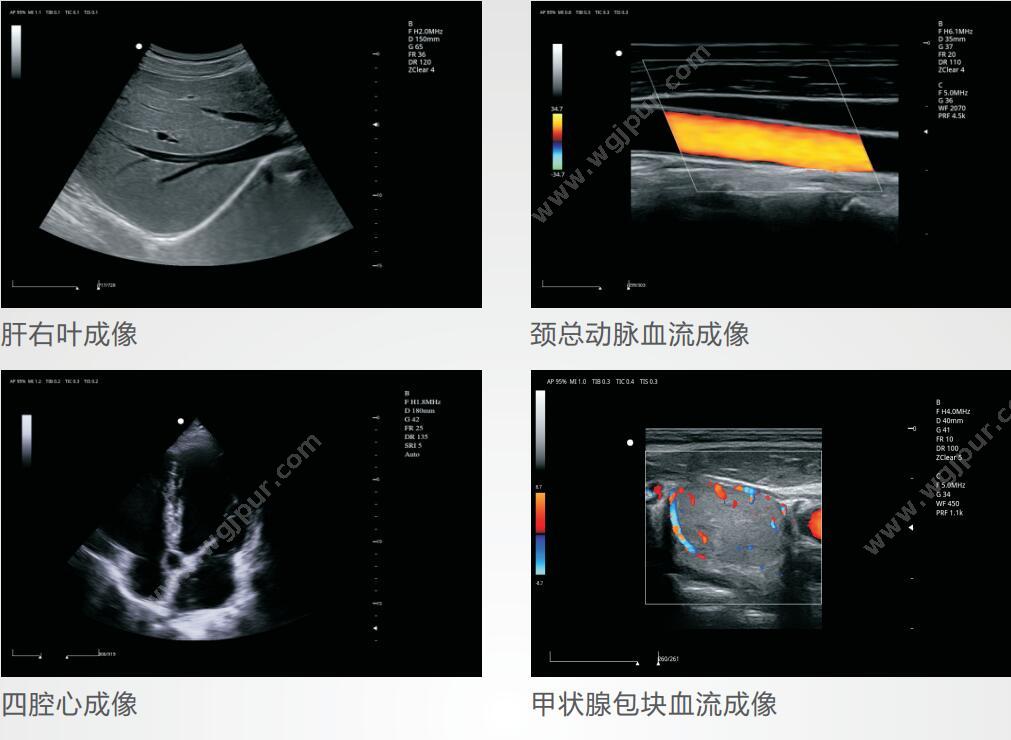 中旗 Zoncare 彩色多普勒超声系统 ZONCARE-V5（主机+腹部探头） 彩超