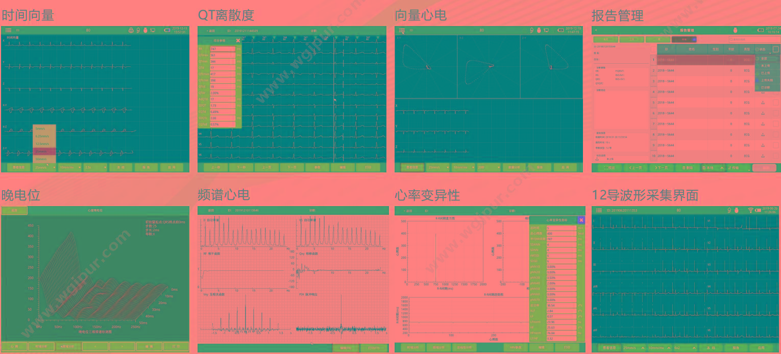 中旗 Zoncare 数字式多道心电图机 iMAC 1200 心电图机