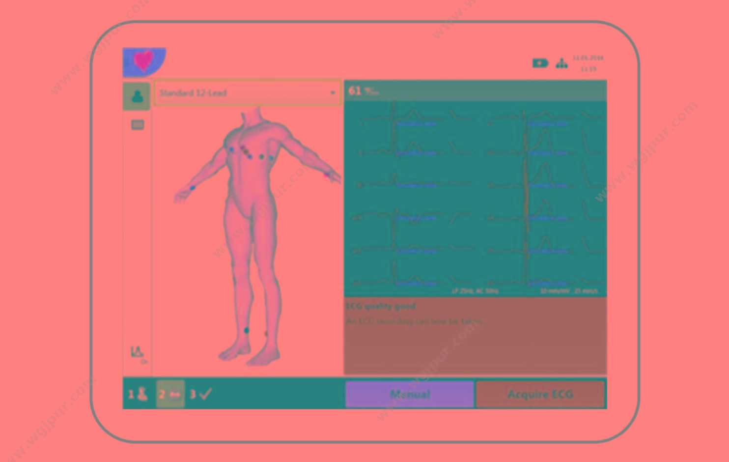 席勒 Schiller 心电图机 CARDIOVIT FT-1 心电图机