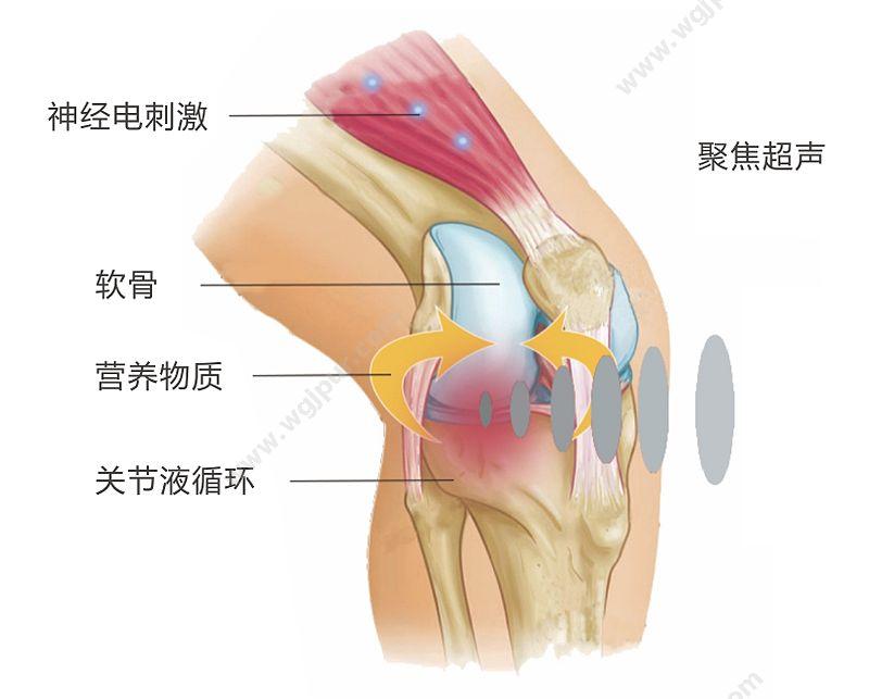 泰步 复合超声关节炎治疗仪 TY-LS-100 超声波治疗仪