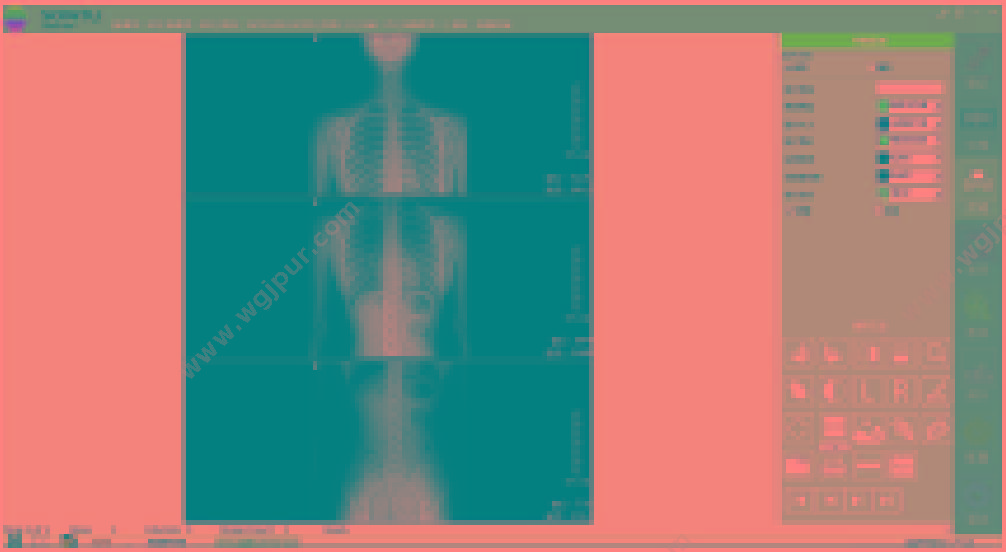 深图 SONTU 数字化透视摄影X射线机 SONTU500-Sirius UC 数字DR