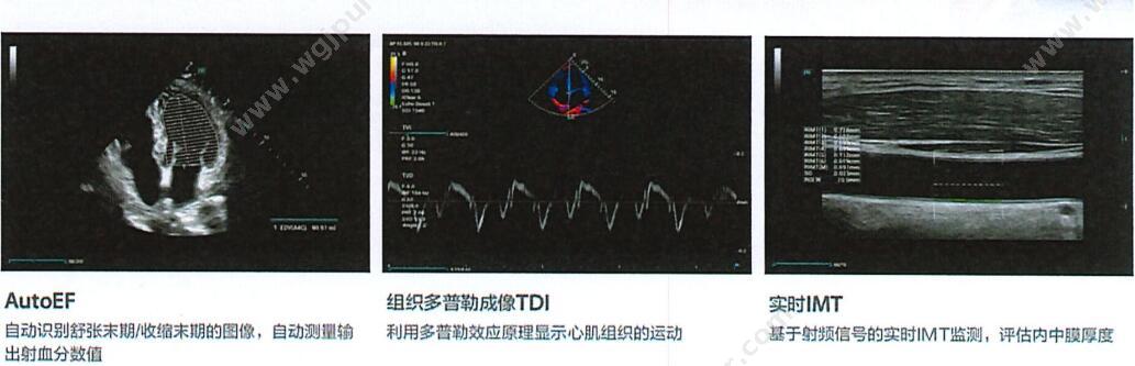 迈瑞 Mindray 彩色多普勒超声系统Consona AT（腔内标配） 彩超