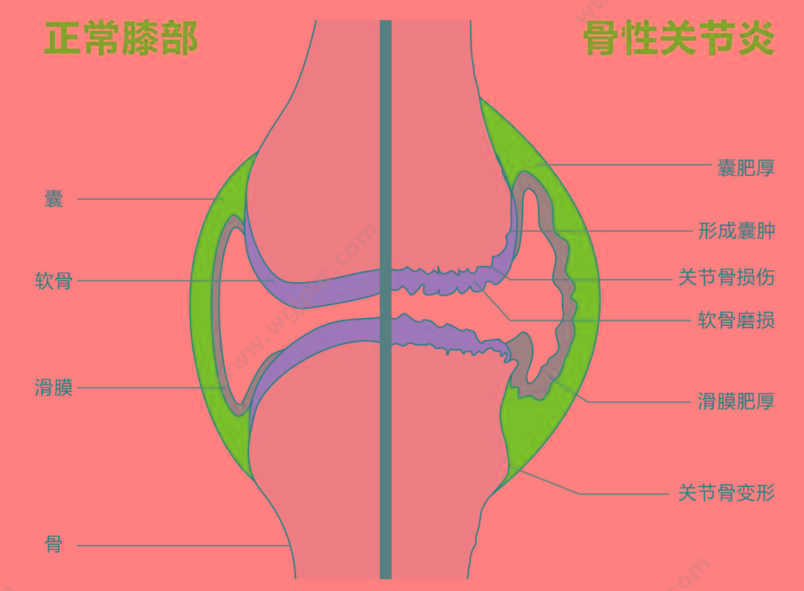 泰步 复合超声关节炎治疗仪 TY-LD-200 超声波治疗仪