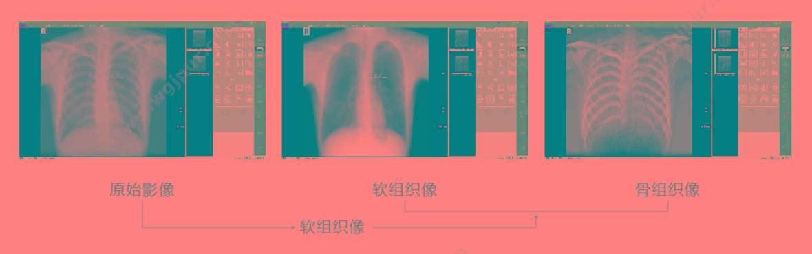 深图 SONTU 数字化X射线成像系统 SONTU100-Polaris50 数字DR