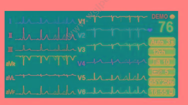 艾瑞康 Aricon 数字心电图机 ECG-3D 心电图机